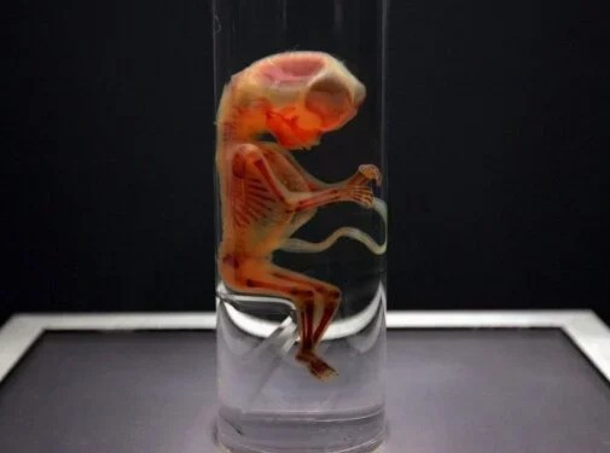 Σε αποχέτευση κτηρίου όπου στεγάζονται γραφεία της ΜΚΟ «Γιατροί Χωρίς Σύνορα» βρέθηκε το ανθρώπινο έμβρυο